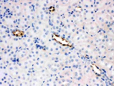 2 - Anti-Glucose Transporter 8 Antibody ABO11477
