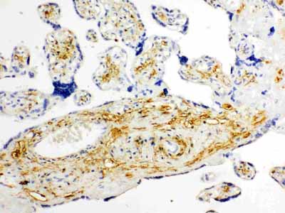 2 - Anti-Glucose Transporter 8 Antibody ABO11477