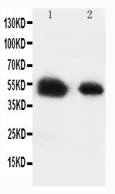 1 - Anti-Glucose Transporter 8 Antibody ABO11477
