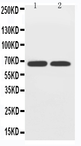 1 - Anti-GLUT12 Antibody ABO11479