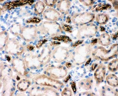2 - Anti-SLC12A1 Antibody ABO11480