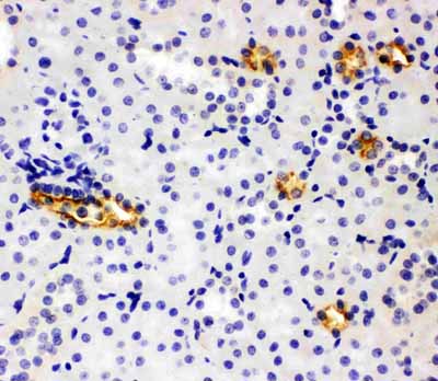 2 - Anti-SLC12A1 Antibody ABO11480