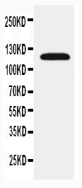 1 - Anti-SLC12A1 Antibody ABO11480