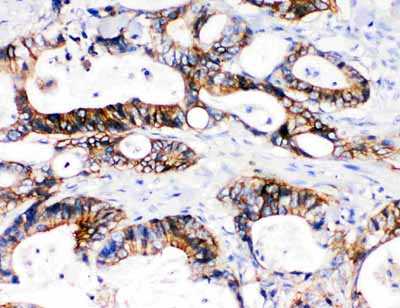 2 - Anti-NKCC1 Antibody ABO11481