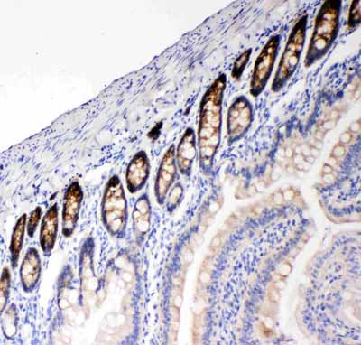 2 - Anti-NKCC1 Antibody ABO11481