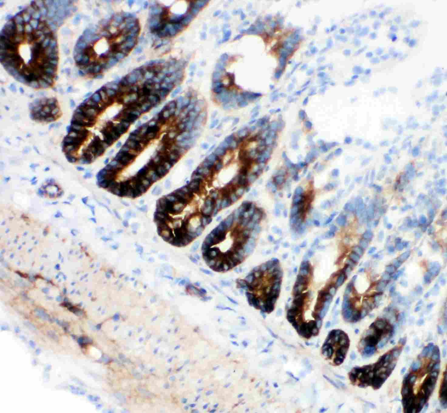 2 - Anti-NKCC1 Antibody ABO11481