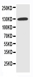 1 - Anti-NKCC1 Antibody ABO11481