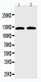 1 - Anti-SLC12A6 Antibody ABO11482