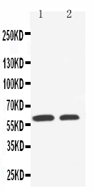1 - Anti-SLC22A1 Antibody ABO11483