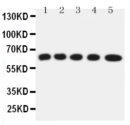 1 - Anti-Solute Carrier Family 22 Member 5 Antibody ABO11484