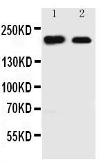 1 - Anti-Tuberin Antibody ABO11485