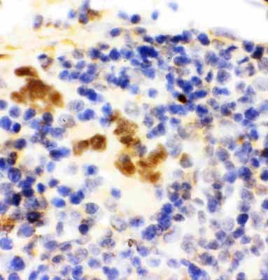 2 - Anti-FLI1 Antibody ABO11488