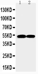 1 - Anti-FLI1 Antibody ABO11488