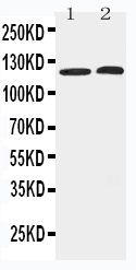 1 - Anti-HDAC5 Antibody ABO11489