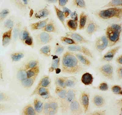 8 - Anti-HYAL1 Antibody ABO11490