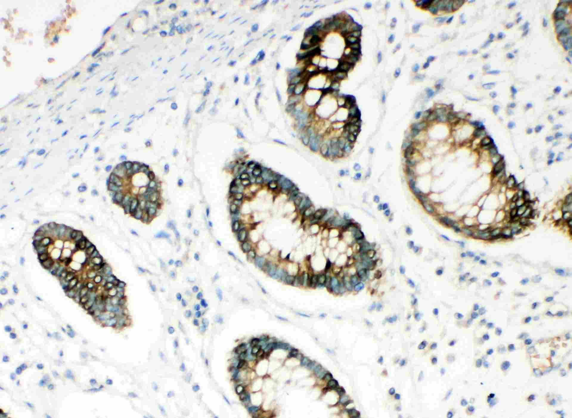 2 - Anti-HYAL1 Antibody ABO11490