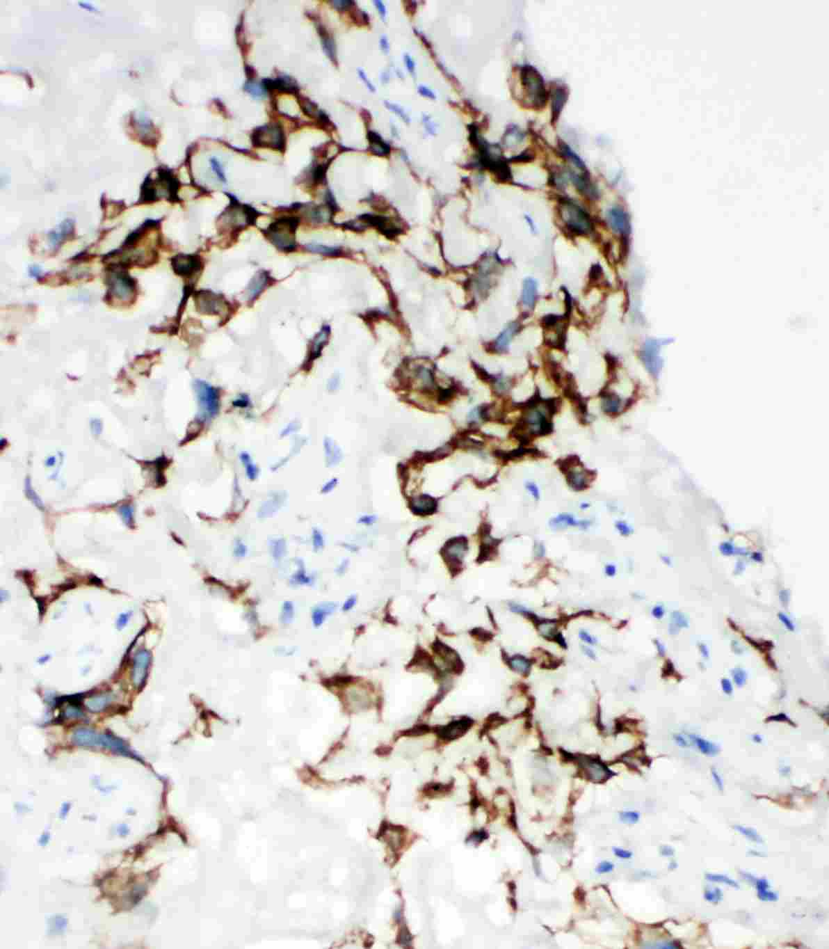 2 - Anti-HYAL1 Antibody ABO11490