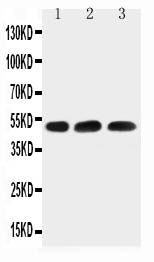 1 - Anti-HYAL1 Antibody ABO11490