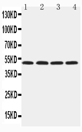 1 - Anti-HYAL1 Antibody ABO11491