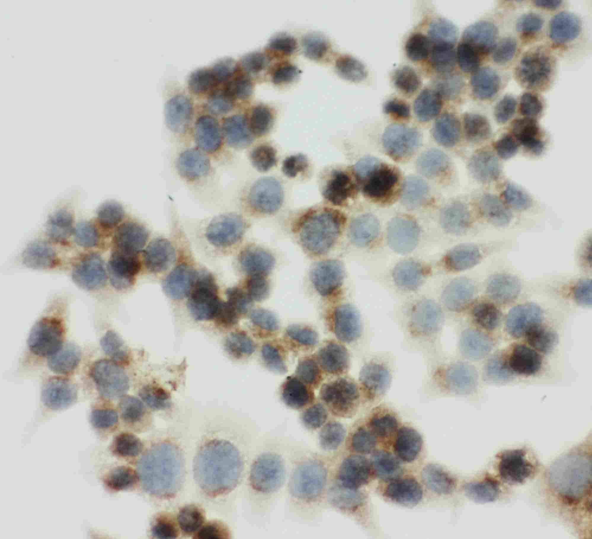 8 - Anti-IGF2R Antibody ABO11492