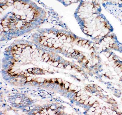 2 - Anti-IGF2R Antibody ABO11492