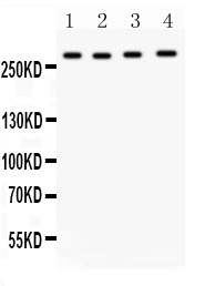 1 - Anti-IGF2R Antibody ABO11492