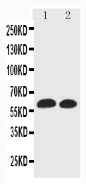 1 - Anti-EAAT1 Antibody ABO11495