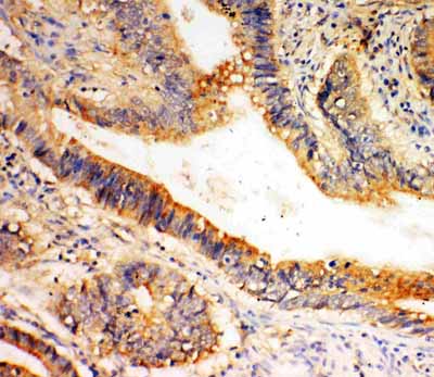 2 - Anti-SLC1A4 Antibody ABO11496