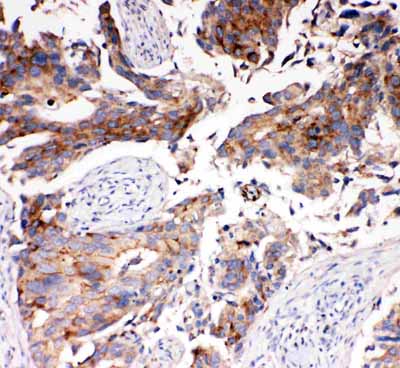 2 - Anti-SLC16A4 Antibody ABO11498