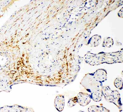 2 - Anti-SLC16A4 Antibody ABO11498
