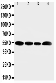 1 - Anti-SLC16A4 Antibody ABO11498