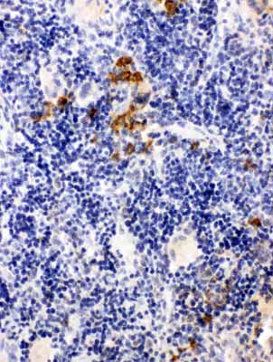 2 - Anti-Leupaxin Antibody ABO11504