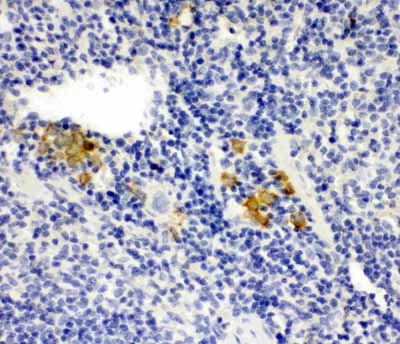 2 - Anti-Leupaxin Antibody ABO11504