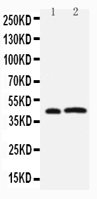1 - Anti-Leupaxin Antibody ABO11504