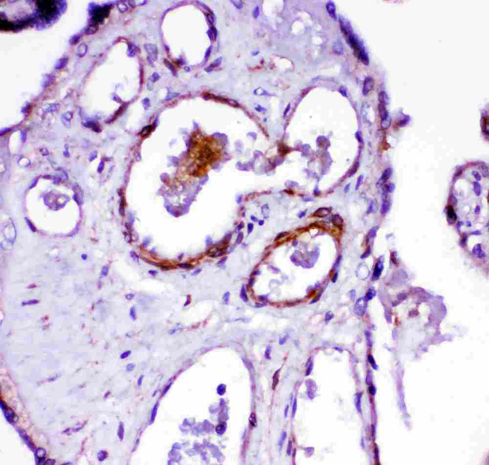 2 - Anti-ACE Antibody ABO11505
