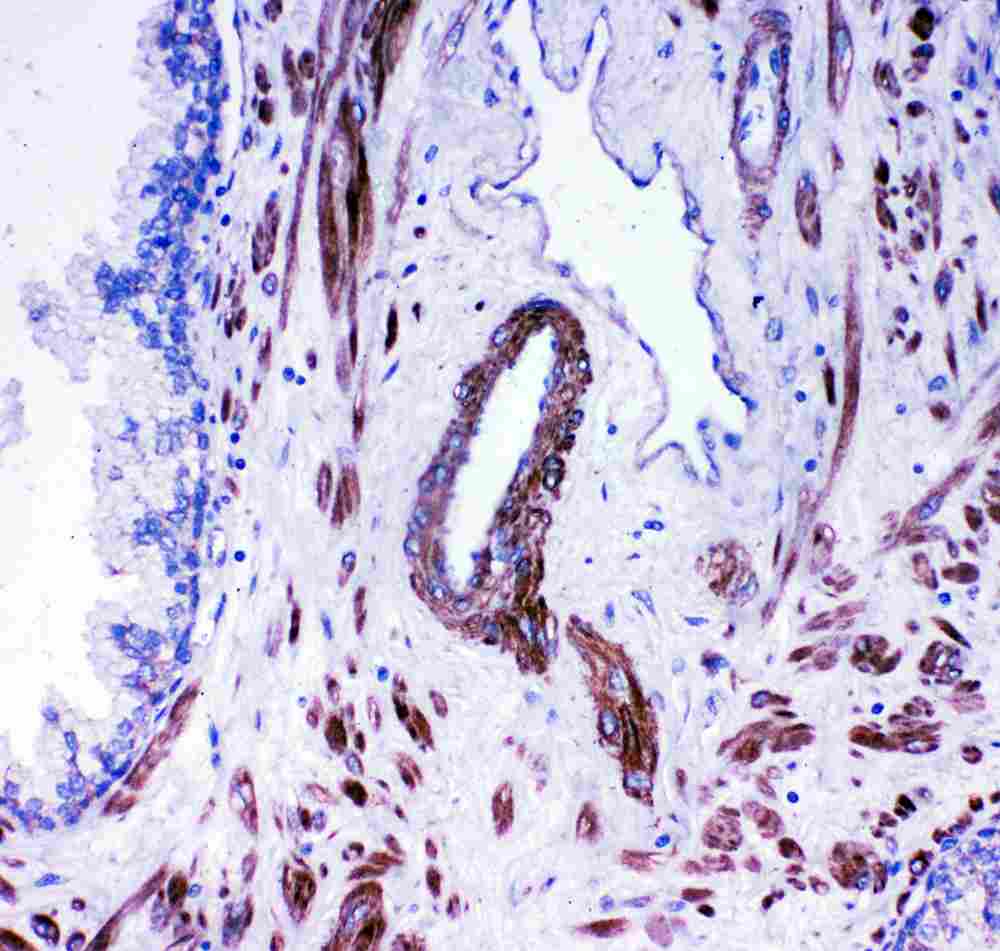 2 - Anti-ACE Antibody ABO11505