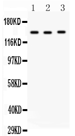 1 - Anti-ACE Antibody ABO11505