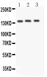 1 - Anti-ACE Antibody ABO11506