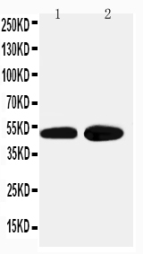 1 - Anti-Alpha 2A Adrenergic Receptor Antibody ABO11507