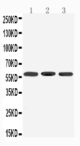 1 - Anti-Dopamine Receptor D5 Antibody ABO11514
