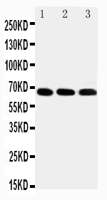 1 - Anti-IRAKM Antibody ABO11517