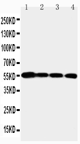 1 - Anti-MMP24 Antibody ABO11522