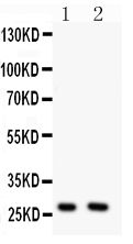1 - Anti-Olig1 Antibody ABO11523