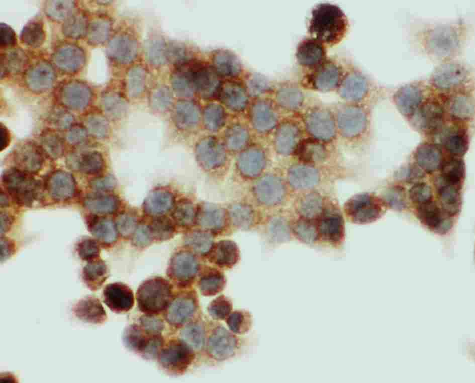 8 - Anti-HNF6 Antibody ABO11524
