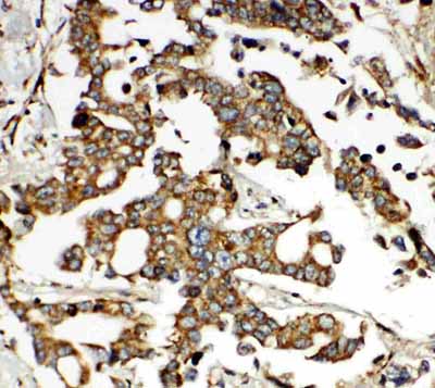 2 - Anti-HNF6 Antibody ABO11524