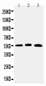 1 - Anti-HNF6 Antibody ABO11524