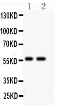 1 - Anti-PIAS4 Antibody ABO11525