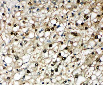 2 - Anti-Selenium Binding Protein 1 Antibody ABO11526