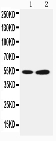 1 - Anti-Selenium Binding Protein 1 Antibody ABO11526
