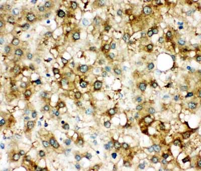2 - Anti-Alpha 1 Antichymotrypsin Antibody ABO11527